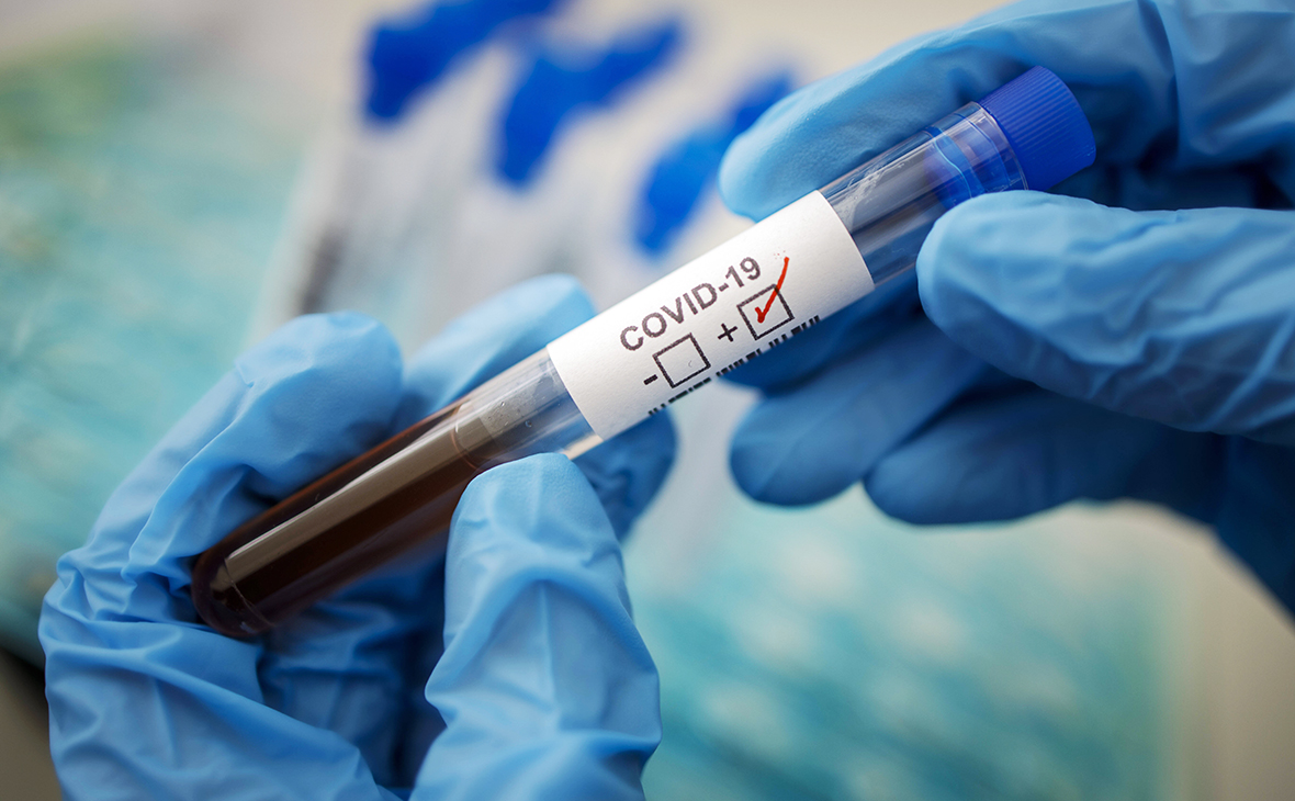 В Україні понад 10 тисяч нових випадків COVID-19