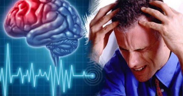 У Миколаєві успішно застосовують сучасний метод лікування ішемічного інсульту