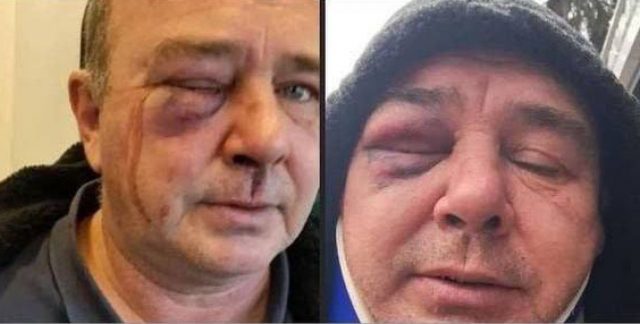 У Київській області працівники ТЦК жорстоко побили чоловіка на очах у поліції, — соцмережі