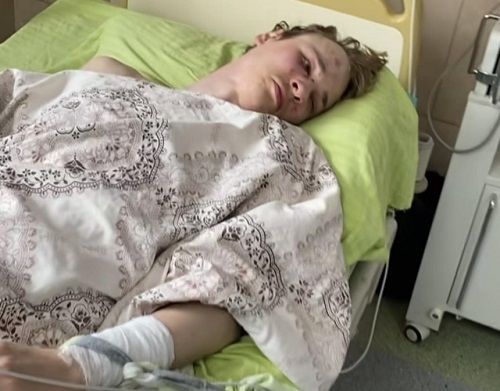 «Завдав сам собі каліцтва»: Закарпатське ТЦК заперечує застосування фізичної сили